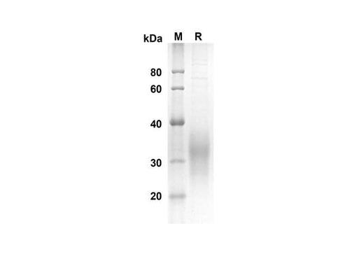 SDS-PAGE analysis of Human SCF proteins, 2 μg/lane of Recombinant Human SCF proteins was resolved with an SDS-PAGE under reducing conditions, showing bands at 18.0 kDa.