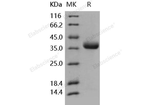 Recombinant Human PRLR/Prolactin Receptor Protein (His Tag) - ABMIUM