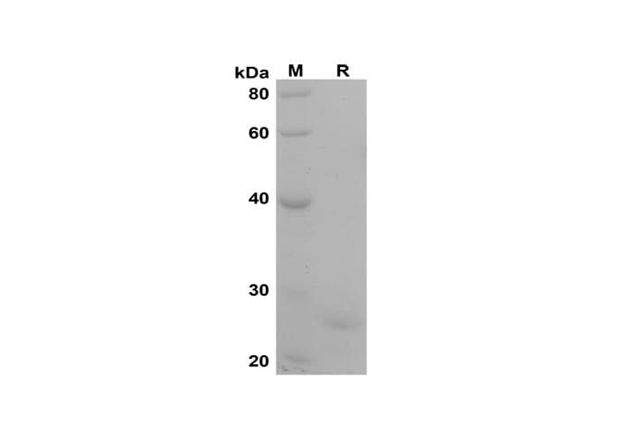 SDS-PAGE analysis of Human ELN proteins, 2 μg/lane of Recombinant Human ELN proteins was resolved with SDS-PAGE under reducing conditions, showing bands at 25 kDa.