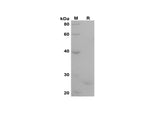 SDS-PAGE analysis of Human ELN proteins, 2 μg/lane of Recombinant Human ELN proteins was resolved with SDS-PAGE under reducing conditions, showing bands at 25 kDa.