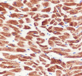 Anti-Human/Rat/Mouse MYH7 Antibody [A707]