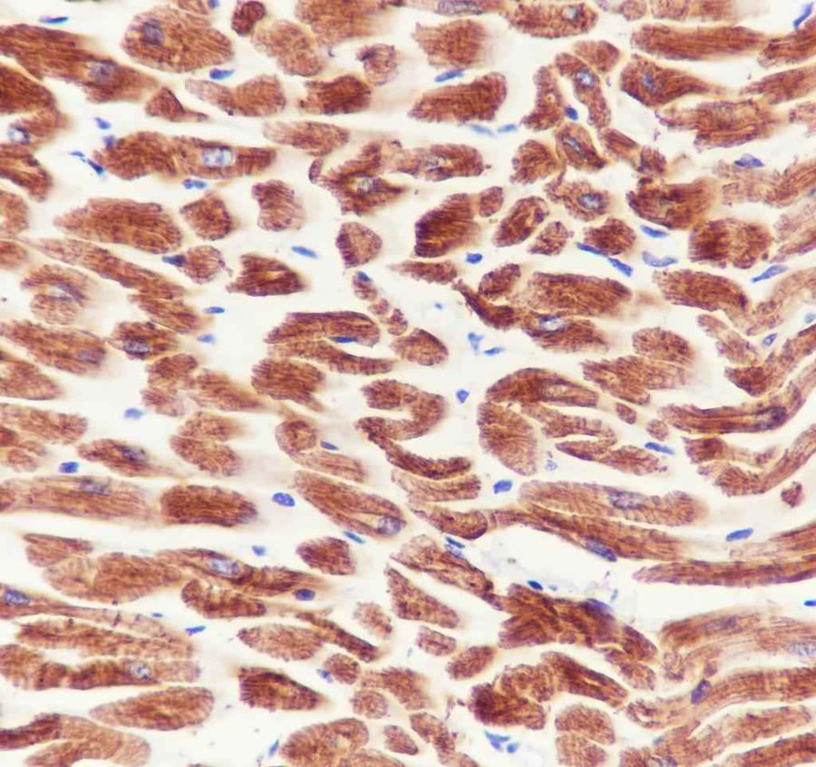 Anti-Human/Rat/Mouse MYH7 Antibody [A707]