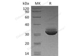 Recombinant Human CELA3A Protein (His Tag) - ABMIUM