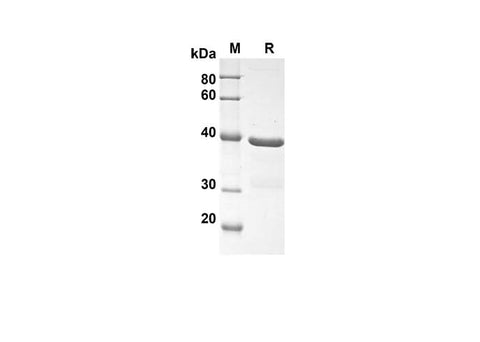 SDS-PAGE analysis of Human CT1 proteins, 2 μg/lane of Recombinant Human CT1 proteins was resolved with an SDS-PAGE under reducing conditions, showing bands at 41.8 kDa.