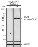 Anti-Human/Mouse Phospho-PAK1 (Thr212) Antibody [A824] - ABMIUM