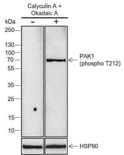 Anti-Human/Mouse Phospho-PAK1 (Thr212) Antibody [A824]
