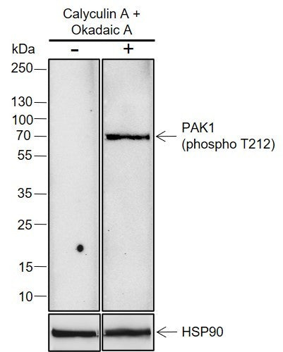 Anti-Human/Mouse Phospho-PAK1 (Thr212) Antibody [A824] - ABMIUM