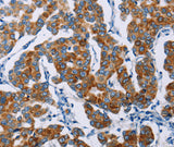 Anti-Human NCR3 Antibody - ABMIUM