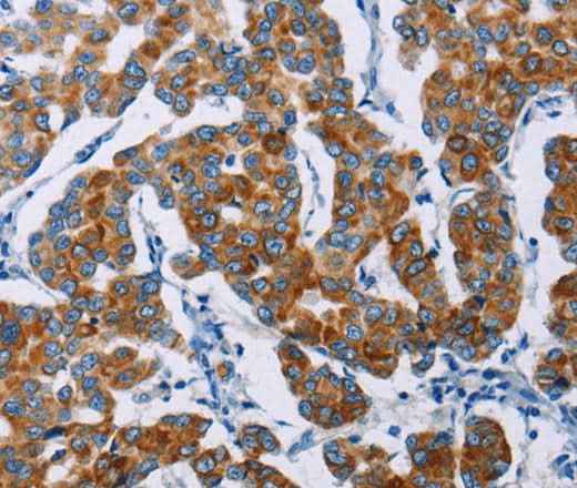 Anti-Human NCR3 Antibody