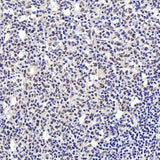 Immunohistochemistry analysis of paraffin-embedded human tonsil using Histone H4 Polyclonal Antibody at dilution of 1:400.