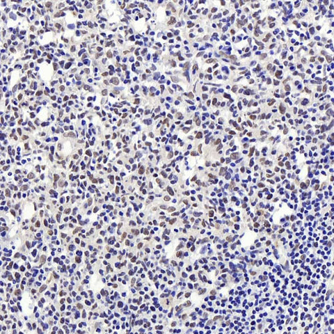 Immunohistochemistry analysis of paraffin-embedded human tonsil using Histone H4 Polyclonal Antibody at dilution of 1:400.