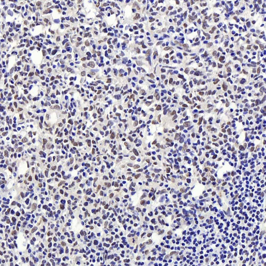 Immunohistochemistry analysis of paraffin-embedded human tonsil using Histone H4 Polyclonal Antibody at dilution of 1:400.