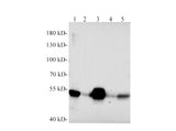 Western blotting with anti-Desmin polyclonal Antibody at dilution of 1:1000. Lane 1: C2C12 cell lysates, lane 2: Mouse heart lysate, lane 3: Mouse skeletal muscle lysate, lane 4: Rat heart lysate, lane 5: Rat skeletal muscle lysate.