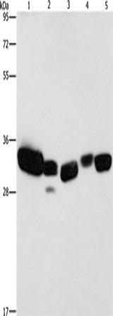 Anti-Human/Mouse/Rat CBR1 Antibody - ABMIUM