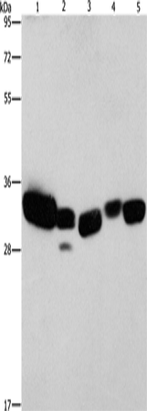 Anti-Human/Mouse/Rat CBR1 Antibody - ABMIUM