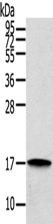 Anti-Human REG3A Antibody - ABMIUM
