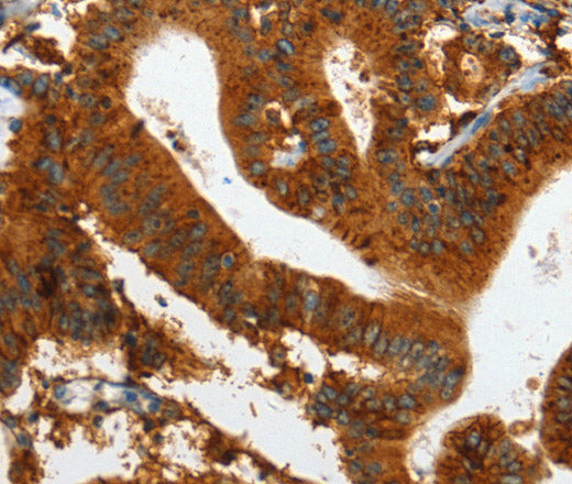 Anti-Human/Mouse IL20RA Antibody - ABMIUM