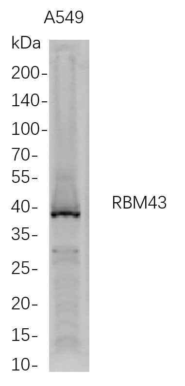 Anti-Human RBM43 Antibody [B690] - ABMIUM