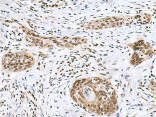 Anti-Human/Mouse INSM1 Antibody