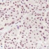 Anti-Human/Rat/Mouse Ataxin-3 Antibody [A135]
