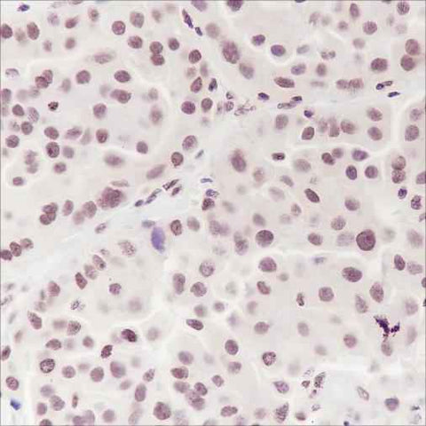 Anti-Human/Rat/Mouse Ataxin-3 Antibody [A135] - ABMIUM