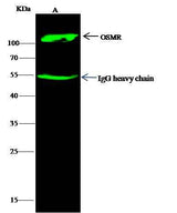 Anti-Human OSMR Antibody [A874] - ABMIUM