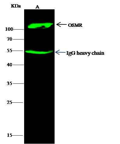 Anti-Human OSMR Antibody [A874] - ABMIUM