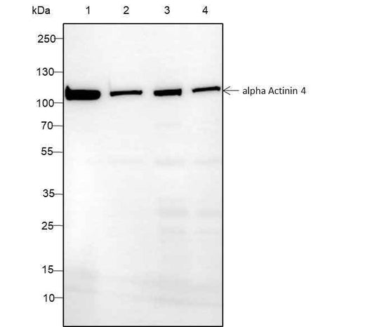 Anti-Human/Mouse alpha Actinin 4 Antibody [A128] - ABMIUM