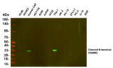 Anti-Human Cleaved N-terminal GSDMD Antibody [B585]