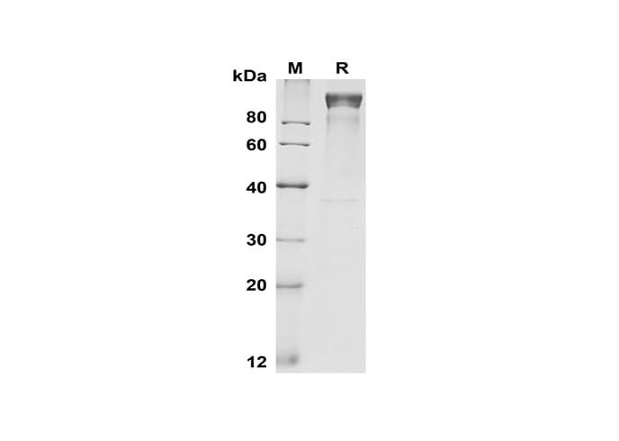SDS-PAGE analysis of Mouse G-CSF R/CD114 proteins, 2 μg/lane of Recombinant Mouse G-CSF R/CD114 proteins was resolved with SDS-PAGE under reducing conditions, showing bands at 100-110 kDa.