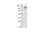 SDS-PAGE analysis of Mouse G-CSF R/CD114 proteins, 2 μg/lane of Recombinant Mouse G-CSF R/CD114 proteins was resolved with SDS-PAGE under reducing conditions, showing bands at 100-110 kDa.
