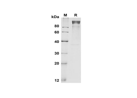SDS-PAGE analysis of Mouse G-CSF R/CD114 proteins, 2 μg/lane of Recombinant Mouse G-CSF R/CD114 proteins was resolved with SDS-PAGE under reducing conditions, showing bands at 100-110 kDa.