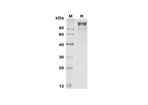 SDS-PAGE analysis of Mouse G-CSF R/CD114 proteins, 2 μg/lane of Recombinant Mouse G-CSF R/CD114 proteins was resolved with SDS-PAGE under reducing conditions, showing bands at 100-110 kDa.
