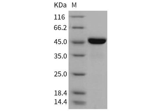 Recombinant Mouse LRPAP1/A2MRAP Protein (His Tag) - ABMIUM