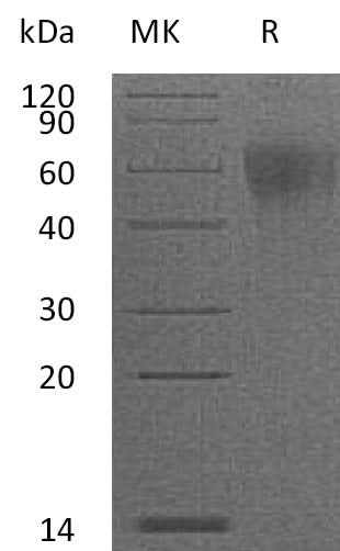 Recombinant Mouse IL-2RG/CD132 Protein (His Tag) - ABMIUM