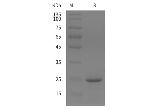 SDS-PAGE analysis of Mouse CD146/MCAM proteins, 2 μg/lane of Recombinant Mouse CD146/MCAM proteins was resolved with SDS-PAGE under reducing conditions, showing bands at 35 kDa.