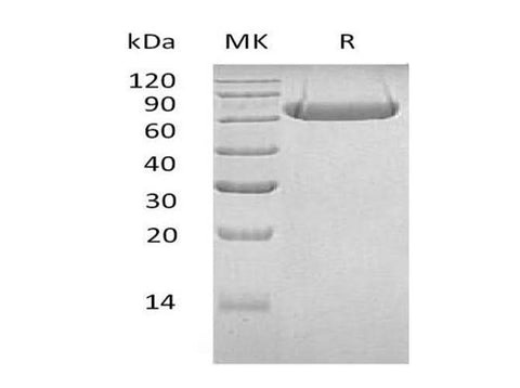 Recombinant Human LAG3/CD223 Protein (His Tag) - ABMIUM