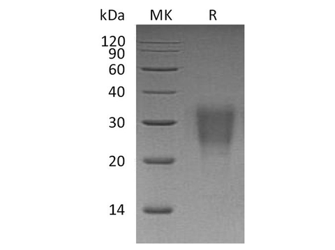 Recombinant Human Interleukin-22/IL-22 Protein (His Tag) - ABMIUM