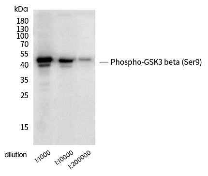 Anti-Human GSK3B Antibody [A1258] - ABMIUM