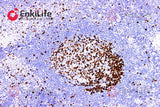 Polymer-HRP Anti-Mouse/Rabbit IHC Detection System(DAB solution） - ABMIUM