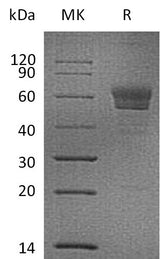Recombinant Mouse Podoplanin/PDPN Protein (Fc Tag) - ABMIUM