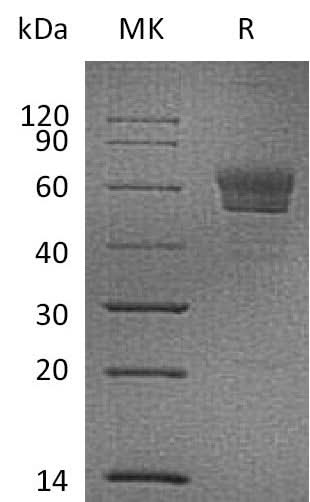 Recombinant Mouse Podoplanin/PDPN Protein (Fc Tag) - ABMIUM