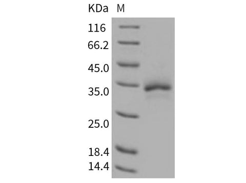 Recombinant Human TFPI2 Protein (His Tag) - ABMIUM