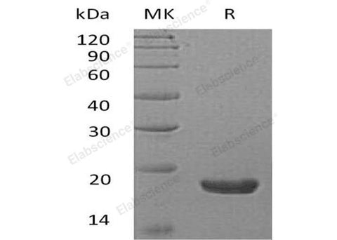 Recombinant Human TXNDC12/ERp18 Protein (His Tag) - ABMIUM