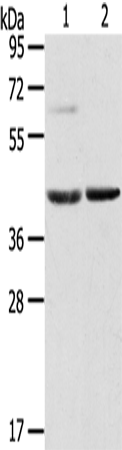 Anti-Human/Mouse HIF1AN Antibody - ABMIUM