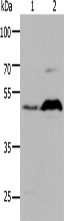 Anti-Human/Mouse/Rat HTR1A Antibody - ABMIUM