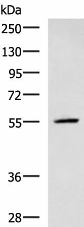 Western blot analysis of A549 cell lysate using CEP57 Polyclonal Antibody at dilution of 1:600