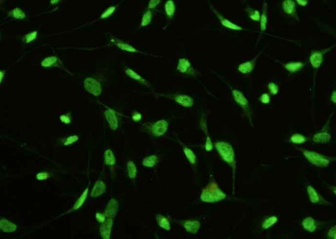 Anti-Human STK4 Antibody [A1065] - ABMIUM