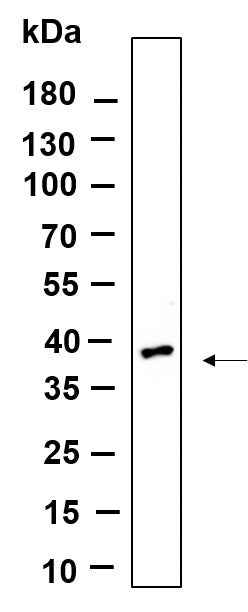 Anti-Human/Mouse/Rat OLIG2 Antibody [B885] - ABMIUM