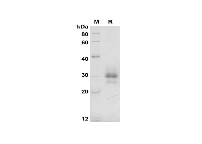 SDS-PAGE analysis of Mouse FLT3LG proteins, 2 μg/lane of Recombinant Mouse FLT3LG proteins was resolved with SDS-PAGE under reducing conditions, showing bands at 28-35 kDa.